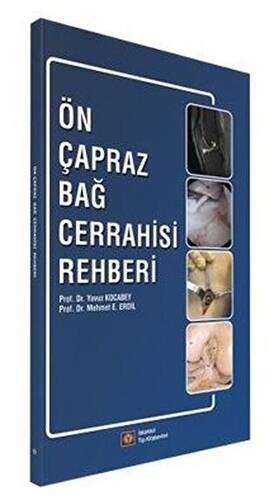 Ön Çapraz Bağ Cerrahisi Rehberi - 1