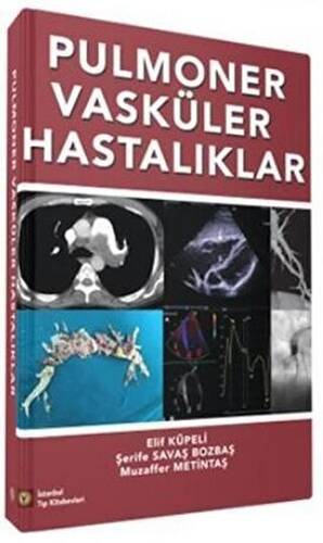 Pulmoner Vasküler Hastalıklar - 1